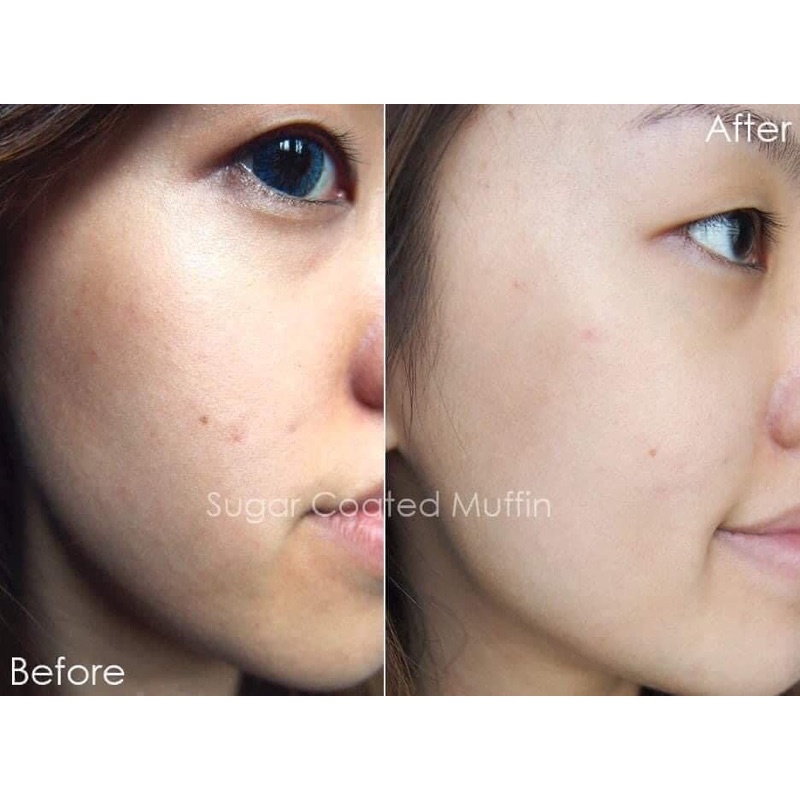 Serum Giảm Thâm Nám Kiehls Clearly Corrective Dark Spot Solution (Kiehl’s)