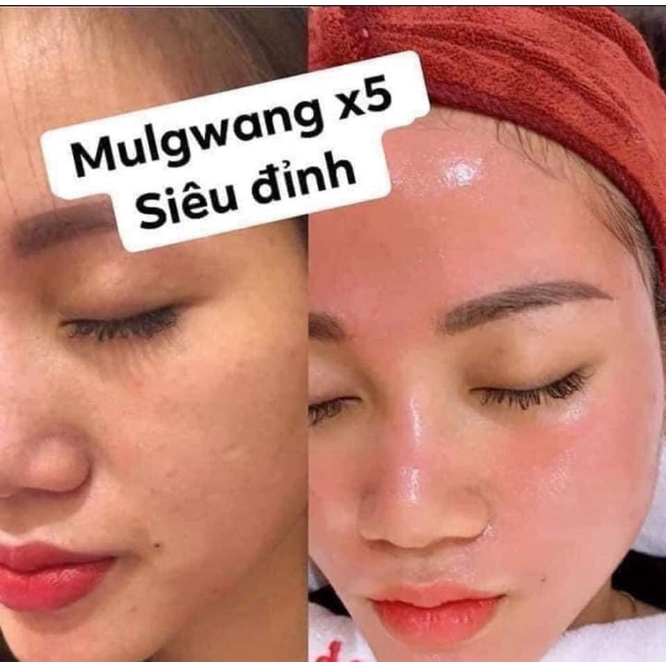 Tinh chất căng bóng da mulwang x5