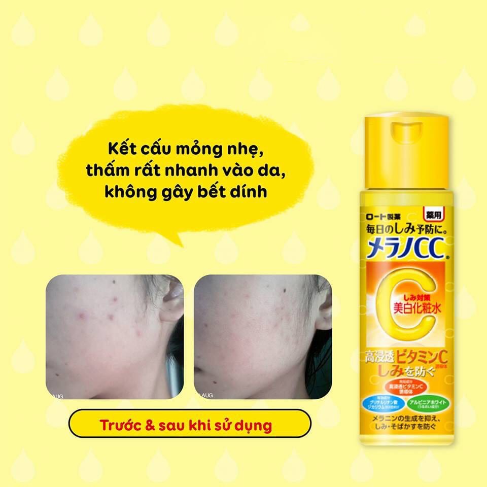 Nước hoa hồng Melano CC Rohto dưỡng trắng ngừa thâm