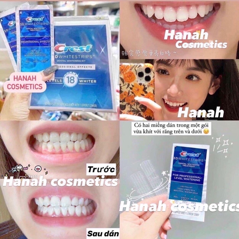 MIẾNG DÁN TRẮNG RĂNG CREST 3D - LẺ 1 MIẾNG