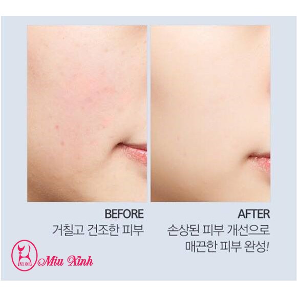 KEM DƯƠNG TRẮNG DA  Super Aqua Cell Renew Snail Cream