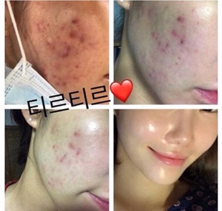 (SALE SỐC - Nên xem) Mulwang Siêu căng bóng X5 - Hàn Quốc