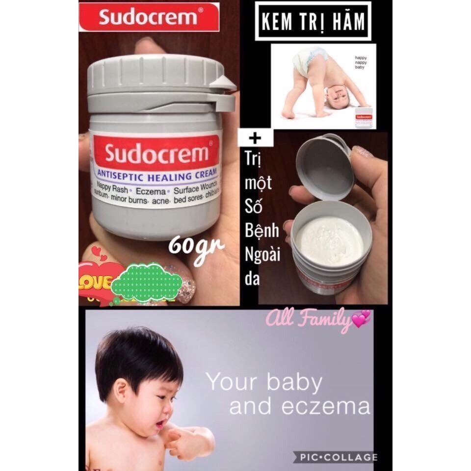 Kem chống hăm tả Sudocream cho bé