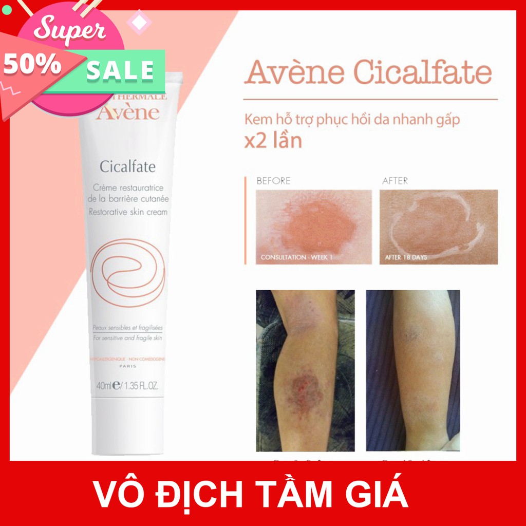 [CHÍNH HÃNG] Kem phục hồi da, lành sẹo, chống nhiễm khuẩn Avene Cicalfate Cream 40ml