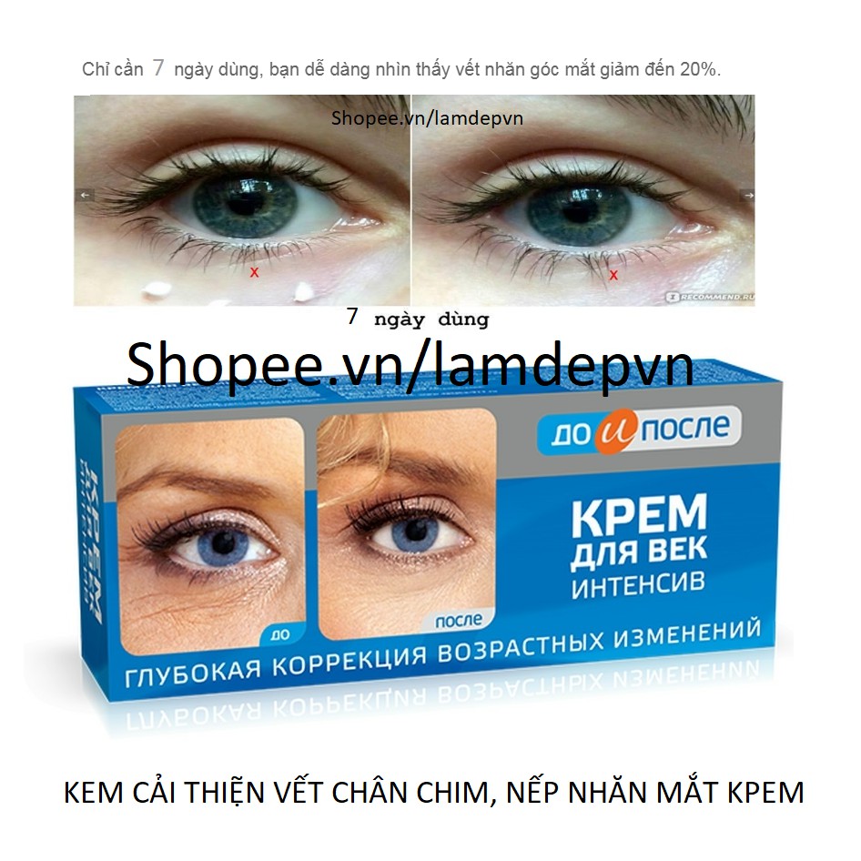 Kem Cải Thiện Vết Chân Chim  Nếp Nhăn Mắt Kpem Nga 30ml INTENSIVE