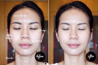 Chấm mụn 𝐌𝐚𝐫𝐢𝐨 𝐁𝐚𝐝𝐞𝐬𝐜𝐮 𝐃𝐫𝐲𝐢𝐧𝐠 𝐋𝐨𝐭𝐢𝐨𝐧 ( bill mỹ)