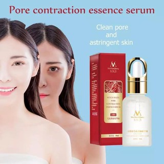 Serum Hết Mụn Se Khích Lỗ Chân Lông Trắng Da