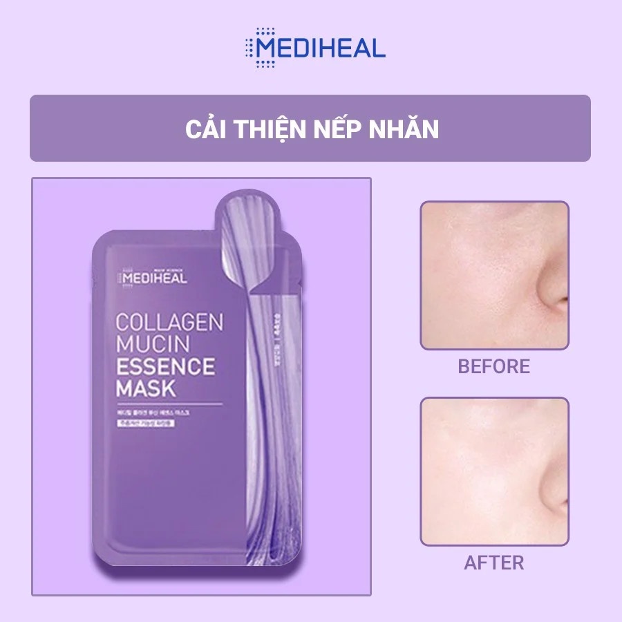Mặt Nạ Giúp Giảm Nếp Nhăn, Chống Lão Hoá Mediheal Essence Mask 20ml - Collagen Mucin