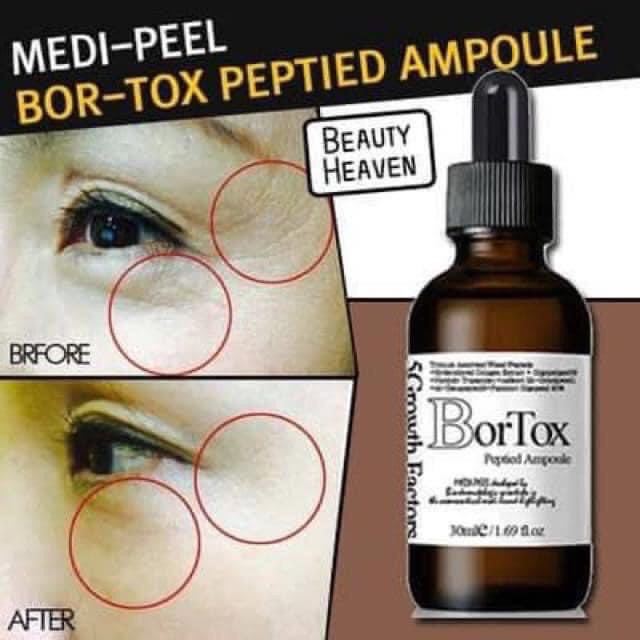 Medipeel- Serum Bor- Tox căng da, làm đầy nếp nhăn 30 ml