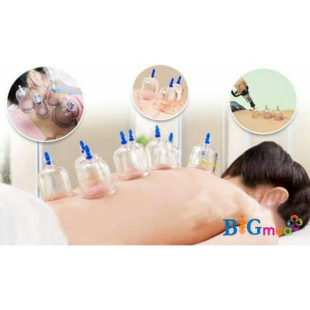 Bộ giác hơi