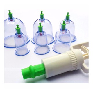 Dụng Cụ Giác Hơi 12 Món Không Cần Lửa