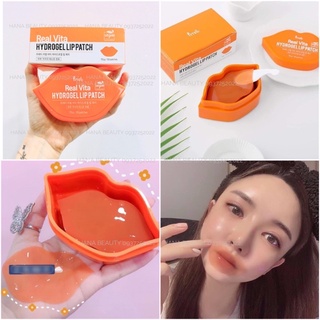Mặt nạ dưỡng Hồng môi Pretti real vita Hydrogel lip Patch