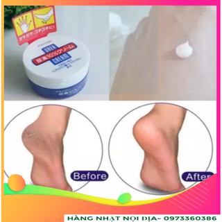 Kem chống nẻ chân tay Shisheido Urea cream 100g Nhật Bản