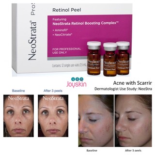 Peel da sinh học Neostrata Prosystem Retinol Peel