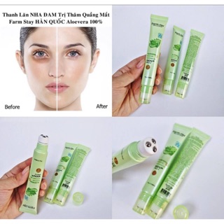 Lăn mắt nha đam giảm thâm quầng mắt sưng bọng mắt