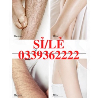 [ CHÍNH HÃNG ] Xịt tẩy lông DETVFO không đau lành tính dịu nhẹ kem tẩy lông nách, tay, chân, lưng dạng xịt 150ml