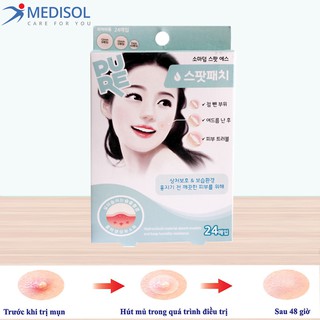 Miếng Dán Mụn Somaderm Spot 24 (3 Size – 24 Miếng)