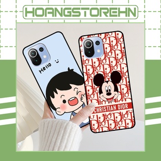 Ốp Xiaomi Mi 11 5G / Mi 11 Lite 5G / Mi 11 Lite 5G NE in hình mickey, hổ, kingtiger siêu rẻ T19 - T24