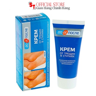 Kem Giảm nứt gót chân Kpem Apteka Chính Hãng 50ml Nga