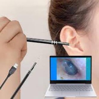 Dụng cụ lấy ráy tai kèm camera nội soi