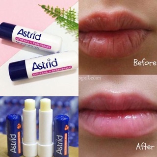 SON DƯỠNG ASTRID