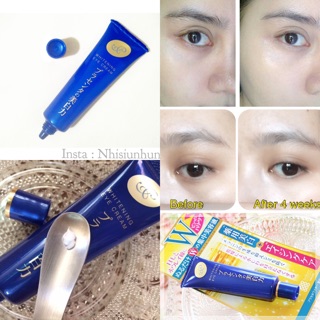Kem Mắt Meishoku Whitening Eye Cream