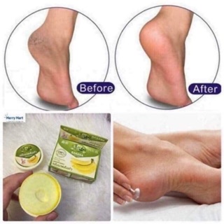 Kem trị nứt gót chân The banana Cream heels