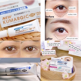 Kem giảm quầng thâm mắt New Kumargic Eye mẫu mới