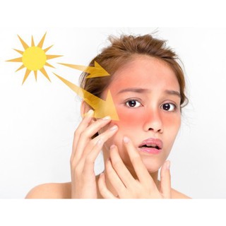 Kem chống nắng Photo derma các loại