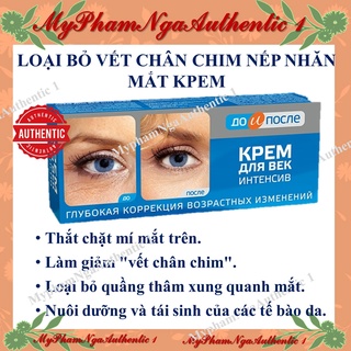 KEM CẢI THIỆN VẾT CHÂN CHIM, NẾP NHĂN MẮT KPEM