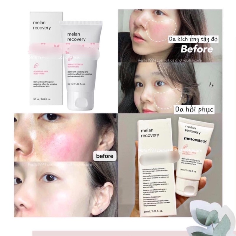 𝐊𝐞𝐦 𝐝𝐮̛𝐨̛̃𝐧𝐠 𝐩𝐡𝐮̣𝐜 𝐡𝐨̂̀𝐢 𝐌𝐞𝐥𝐚𝐧 𝐑𝐞𝐜𝐨𝐯𝐞𝐫𝐲 𝐜𝐫𝐞𝐦𝐞- Mesoestetic