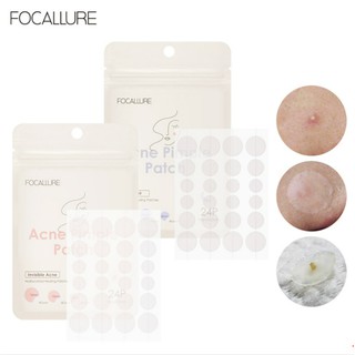 Miếng dán che khuyết điểm và lấy nhân mụn FOCALLURE chống thấm nước chăm sóc da