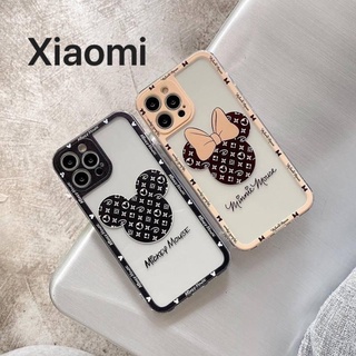 Ốp lưng lỗ viền camera Xiaomi Redmi Note 10 Note 10s Note 11 Note11s Note 10 Pro Note 11 Pro 4G Redmi 10A