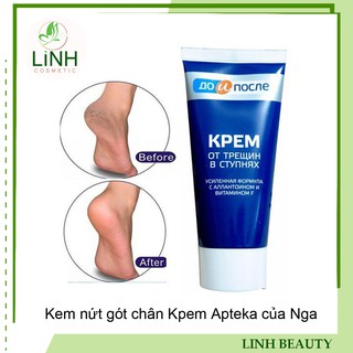 Kem nứt gót chân Kpem Apteka của Nga 50ml