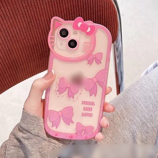 ốp dẻo mèo cute iphone 7 plus/8 plus/X/Xs/XS Max/11/11 pro max/12/12 pro max/13/13 pro max