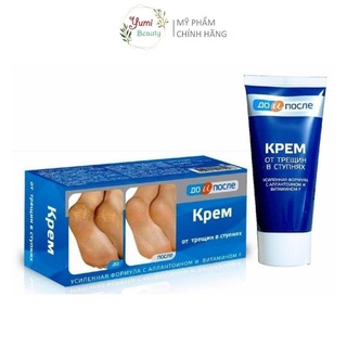 Kem dưỡng nứt nẻ gót chân KPEM 50ml hàng nội địa Nga