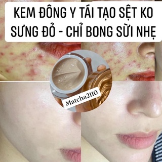 kem tái tạo đông y sệt handmade (ko sưng ko đỏ)