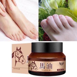 Kem đầu ngựa trị nứt gót chân hũ 30gr hàng nội địa Trung - Kem chống nẻ