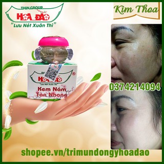 Kem Nám Tàn Nhang Hoa Đào Thingroup chính hãng