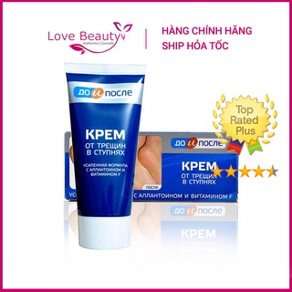 KEM NGĂN NGỪA NỨT NẺ GÓT CHÂN NGA KPEM