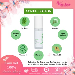 Sữa dưỡng ẩm - Giảm mụn Acnee Lotion giảm thiểu các vùng da bị nổi mụn và cấp ẩm cho làn da
