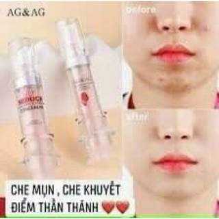 thanh nền che khuyết điểm agag