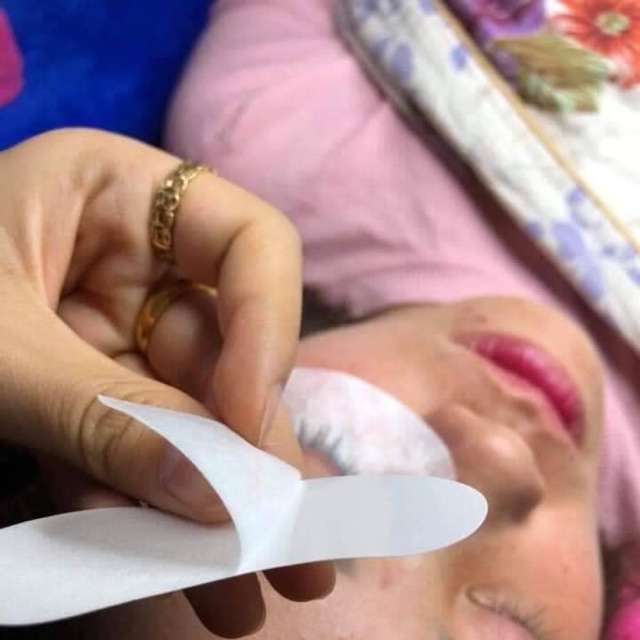 Dán mắt dưới bảo vệ mắt