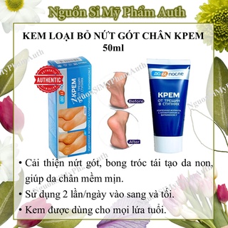 Kem nứt gót chân kpem Nga
