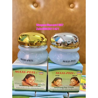 bộ kem dưỡng trắng da ngày , đêm , loại bỏ  mụn, nám ,  tàn nhang, nếp nhăn Maxi-peel 40g.