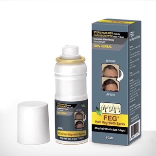 XỊT MỌC TÓC  SIÊU HIỆU QUẢ ( chính hãng)