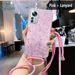 Ốp Điện Thoại Silicon Mềm Trong Suốt Lấp Lánh Sang Trọng Có Dây Đeo Cổ Cho Xiaomi 12T 11T 10T Pro Mi 12 11 Lite 5G NE Poco X3 NFC
