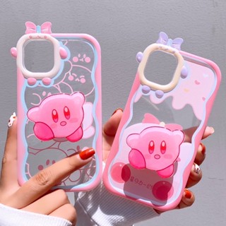 [Iphone/Oppo/Samsung/Vivo/Xiaomi] Ốp Lưng Nơ Trong Suốt - Animel Chibi