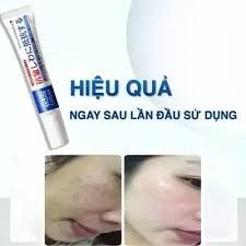 Kem nám tàn nhang cao cấp 𝗻𝗵𝗮̣̂𝘁 𝗯𝗮̉𝗻 𝗰𝗵𝗶́𝗻𝗵 𝗵𝗮̃𝗻𝗴