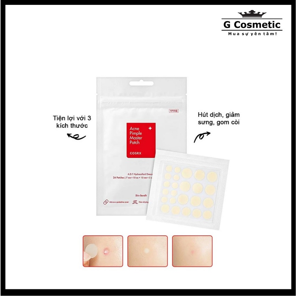 Miếng Dán Mụn Cosrx Master Patch